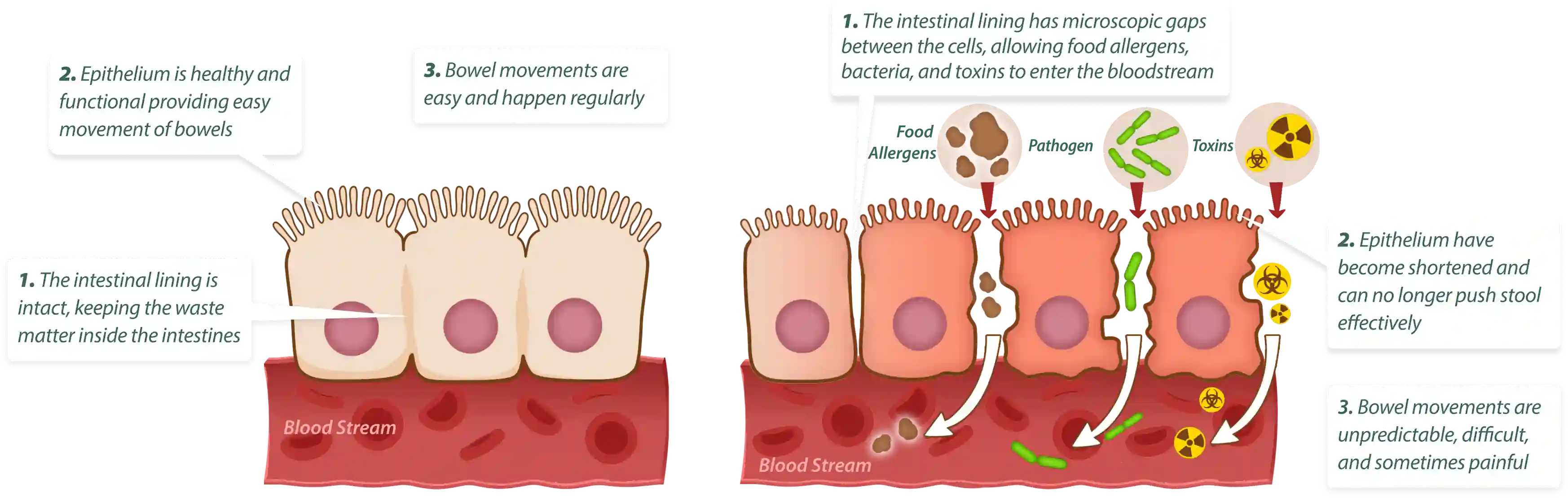 How EmmaReleif works – 3-step gut cleansing and healing process