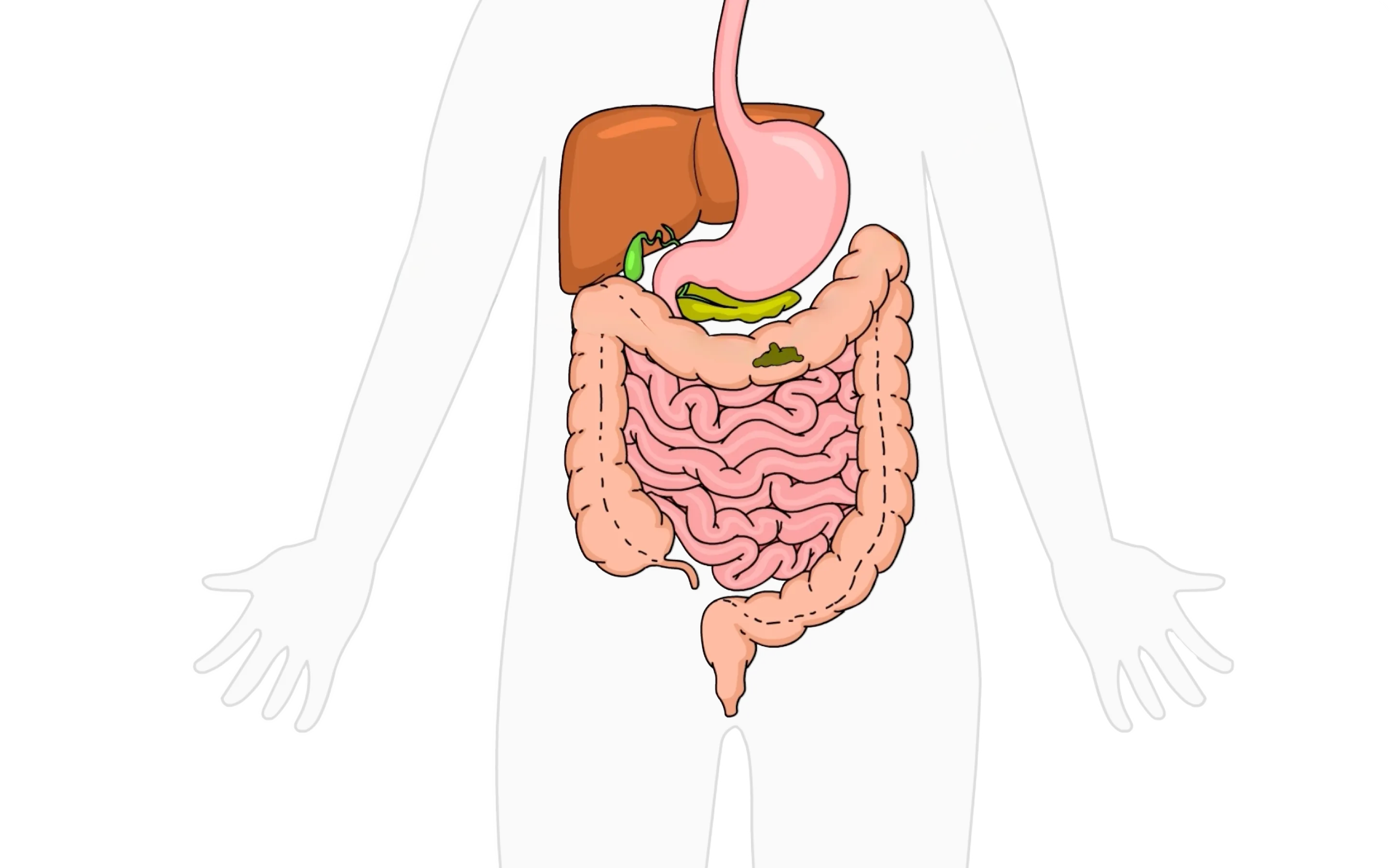 EmmaReleif gut health video illustration
