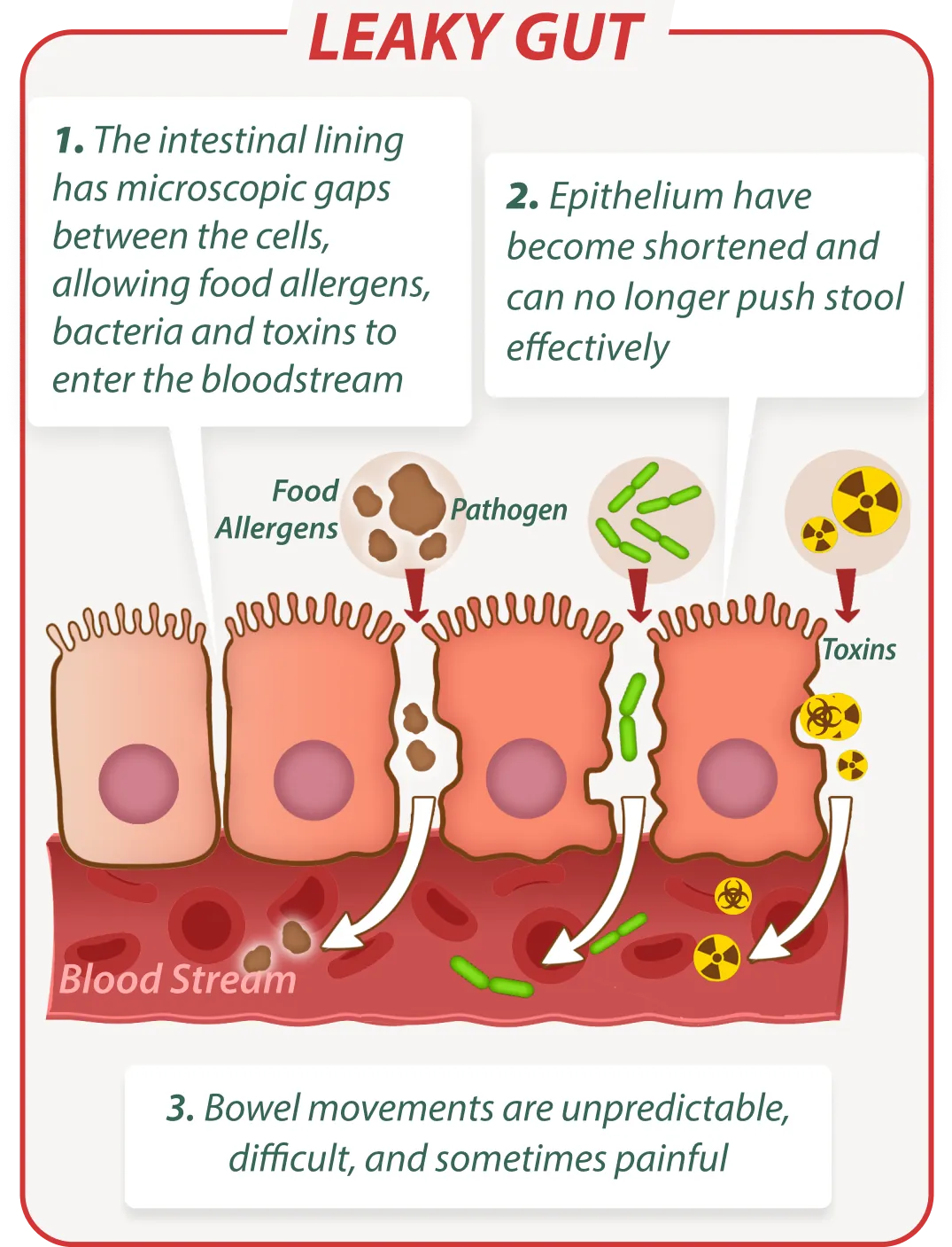 Leaky gut without EmmaReleif – digestive issues illustration